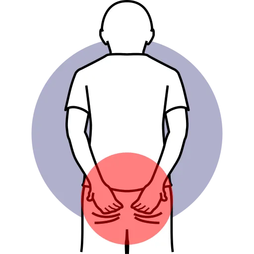 Illustration showing the location of pilonidal disease pain in the lower back and tailbone area